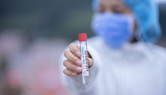KORONA VIRUS: U Srbiji registrovano 178 novih slučajeva zaraze, preminulo još 10 pacijenata